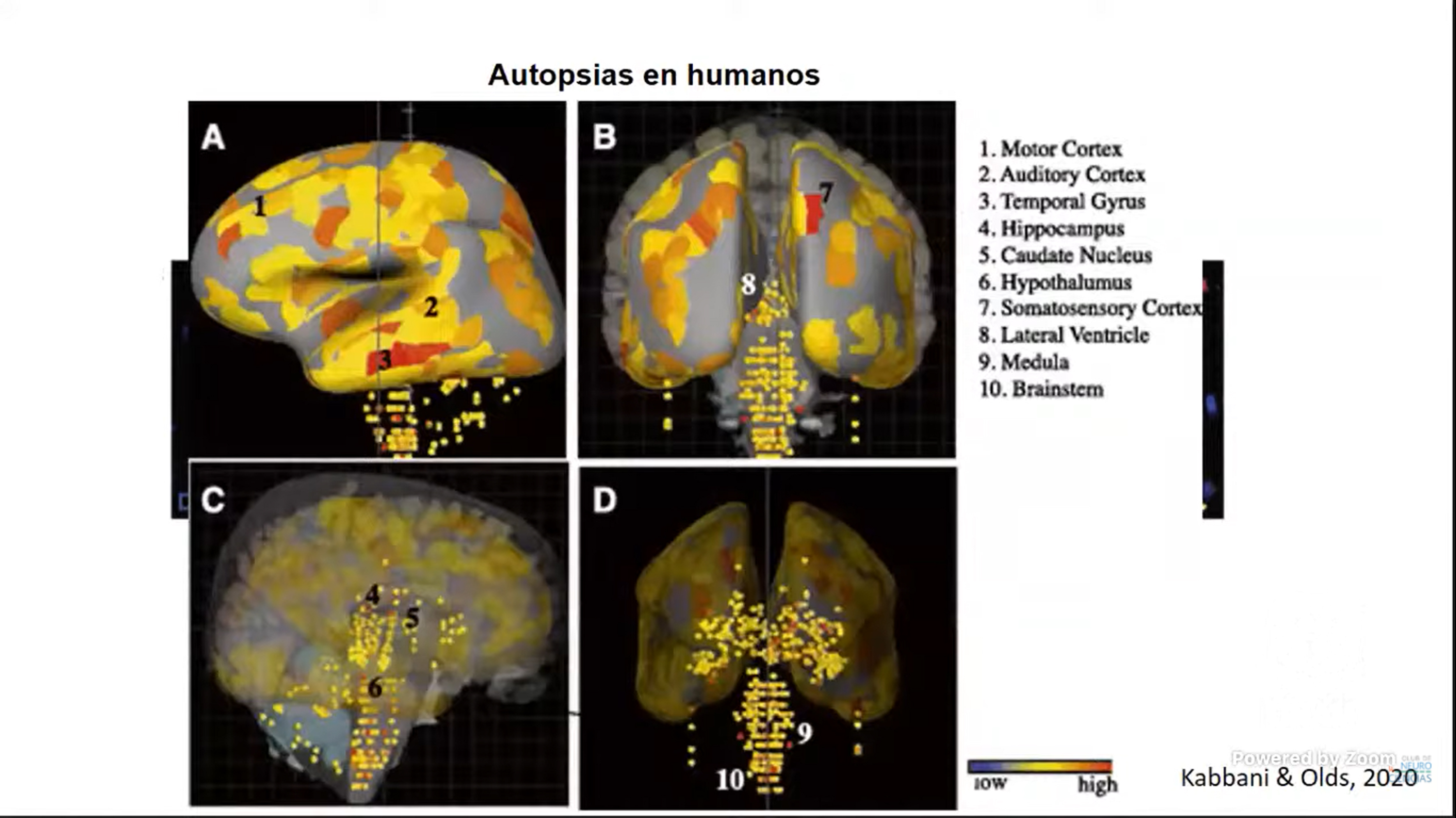 Afectaciones en el cerebro, probables secuelas por la Coivid-19