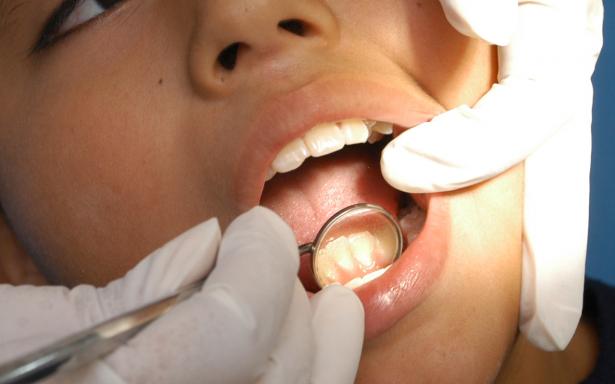Advierte IMSS de hábitos que provocan cáncer en la boca
