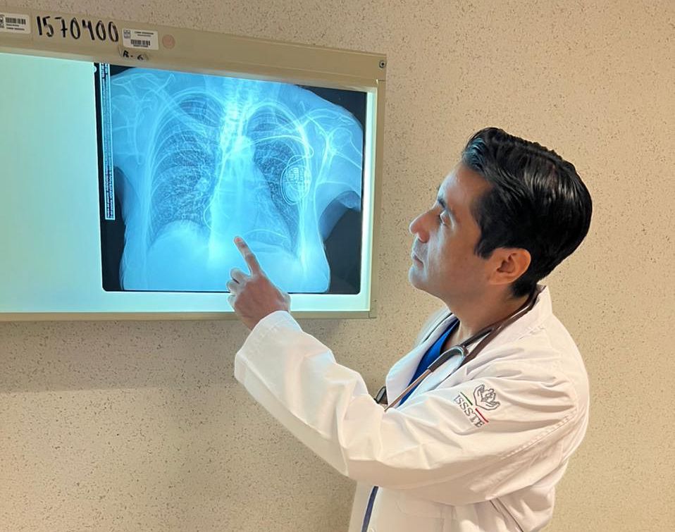 Tabaquismo: enemigo número 1 de la salud pulmonar